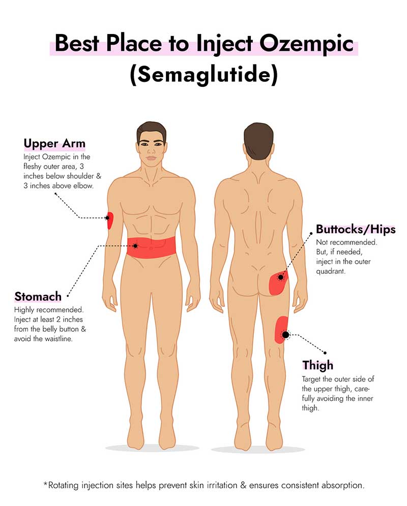 Ozempic Injection Sites